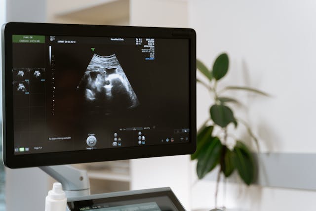 Avant la naissance : une échographie d'un foetus sur un moniteur